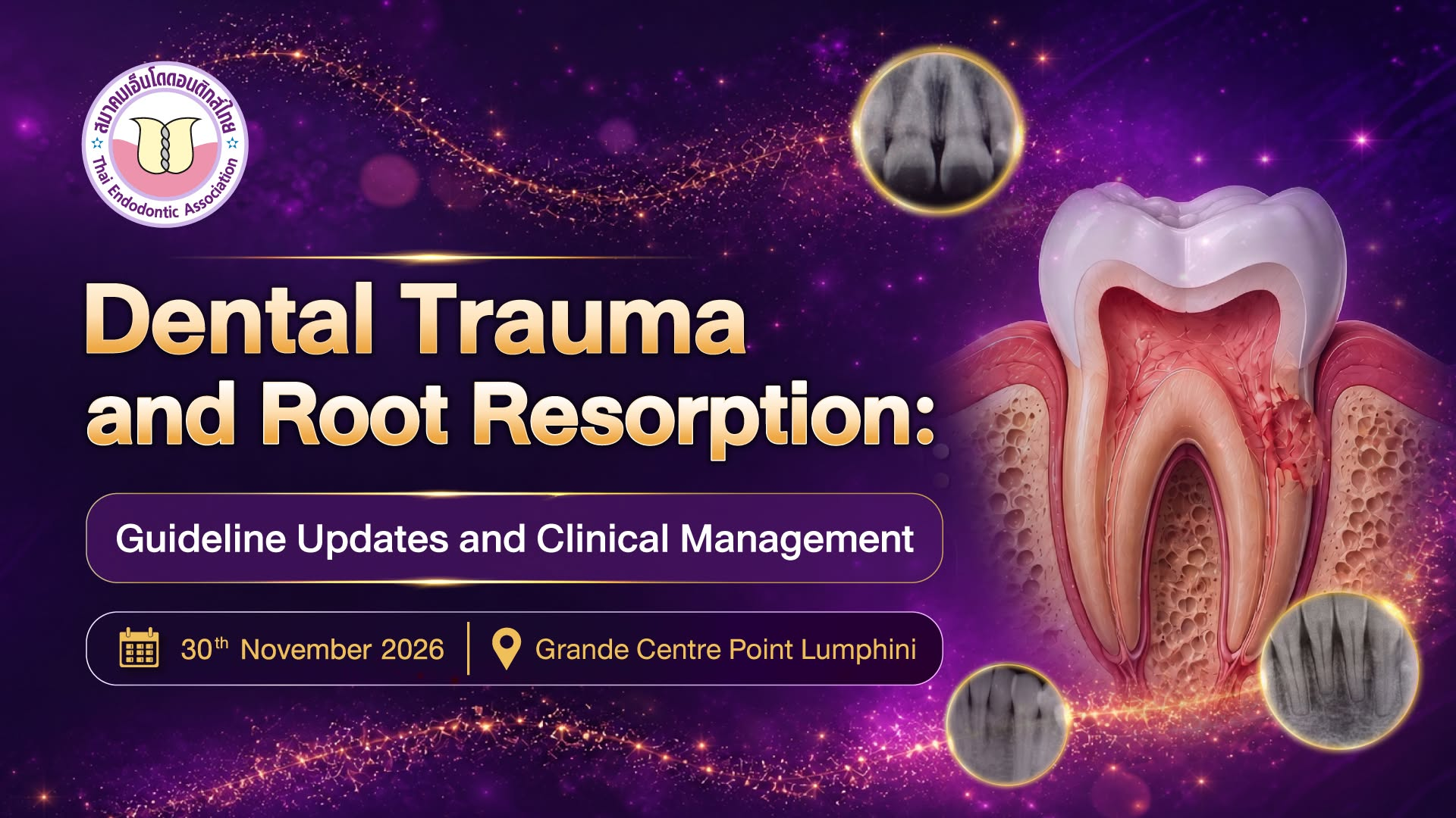 ประชาสัมพันธ์งาน Dental Trauma and Root Resorption 2569
